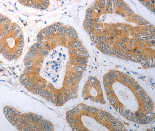 RBMS3 Antibody in Immunohistochemistry (Paraffin) (IHC (P))