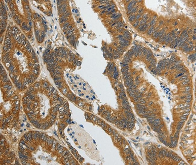 SPAG4L Antibody in Immunohistochemistry (Paraffin) (IHC (P))