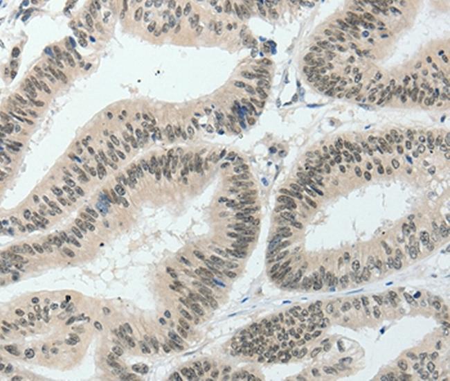 TCF2 Antibody in Immunohistochemistry (Paraffin) (IHC (P))