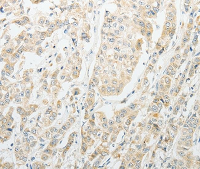 CCP4 Antibody in Immunohistochemistry (Paraffin) (IHC (P))