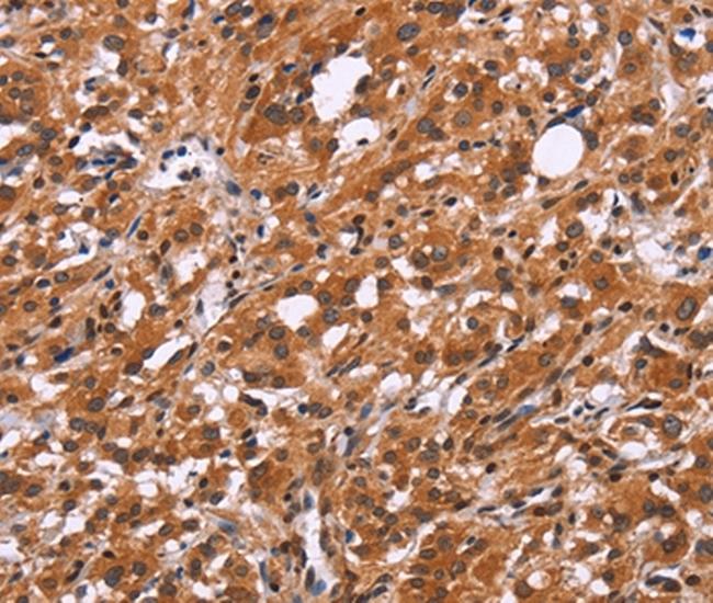 SLC8A2 Antibody in Immunohistochemistry (Paraffin) (IHC (P))