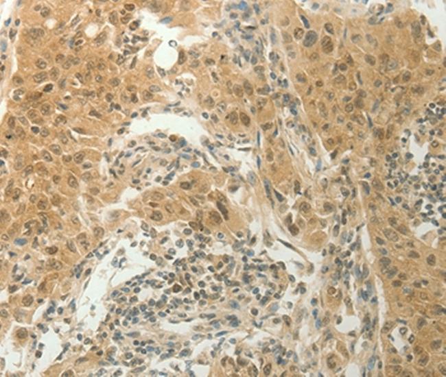 SLC8A3 Antibody in Immunohistochemistry (Paraffin) (IHC (P))