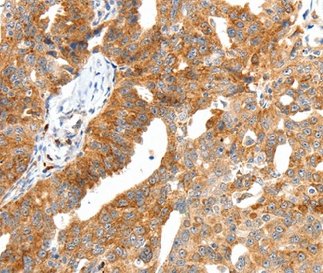 Secretin Antibody in Immunohistochemistry (Paraffin) (IHC (P))