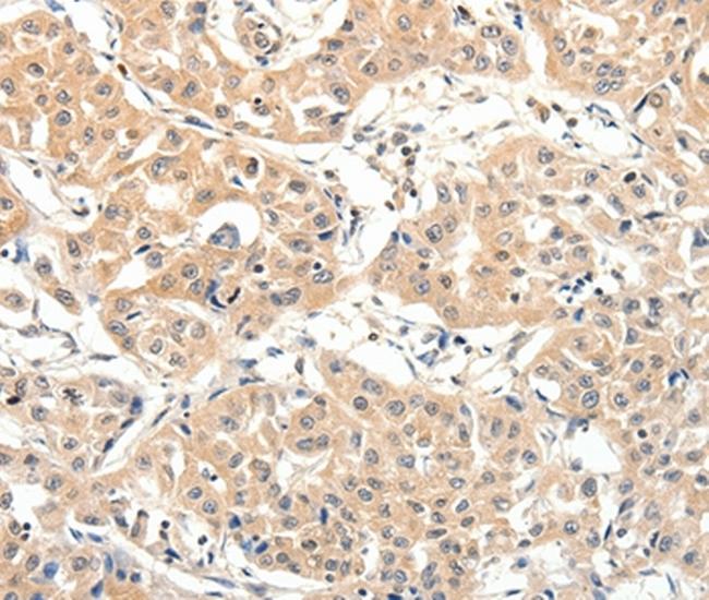 SLC27A1 Antibody in Immunohistochemistry (Paraffin) (IHC (P))