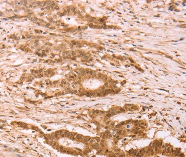 STRA8 Antibody in Immunohistochemistry (Paraffin) (IHC (P))