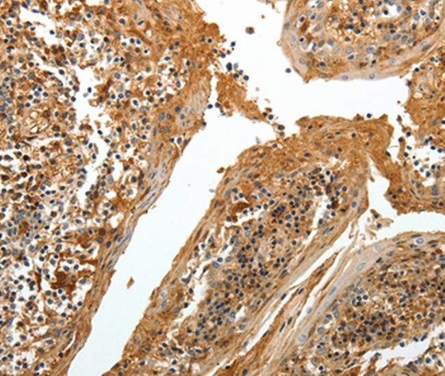 Tenascin R Antibody in Immunohistochemistry (Paraffin) (IHC (P))