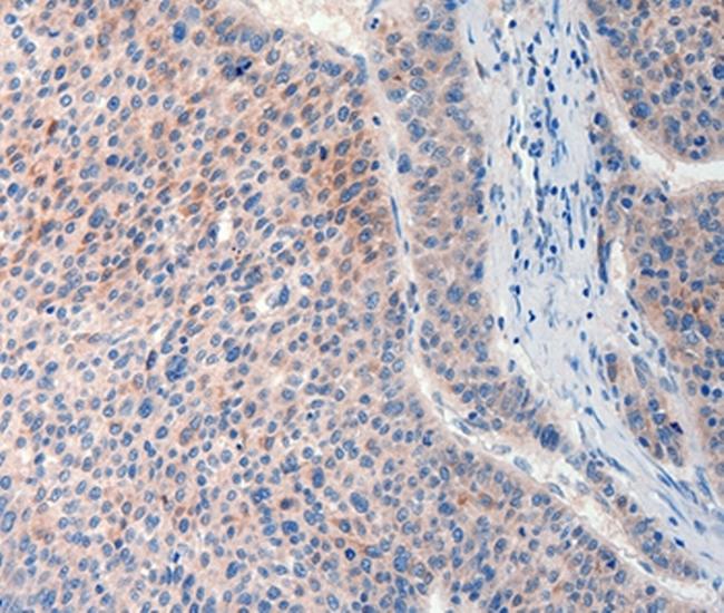 FAT4 Antibody in Immunohistochemistry (Paraffin) (IHC (P))