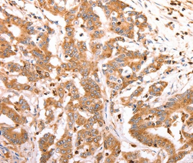 CELSR2 Antibody in Immunohistochemistry (Paraffin) (IHC (P))