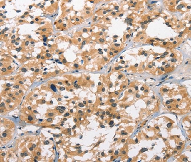 GPR182 Antibody in Immunohistochemistry (Paraffin) (IHC (P))