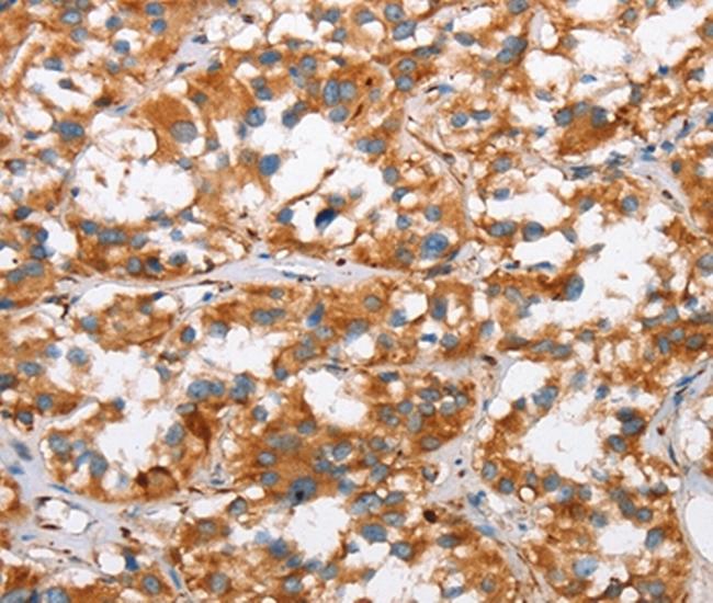 SLC4A1 Antibody in Immunohistochemistry (Paraffin) (IHC (P))