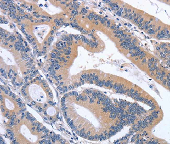 GDF11 Antibody in Immunohistochemistry (Paraffin) (IHC (P))