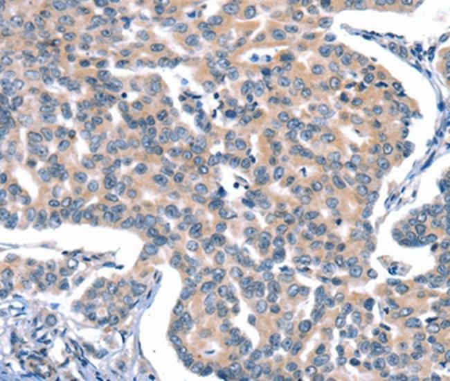 CaV2.1 Antibody in Immunohistochemistry (Paraffin) (IHC (P))