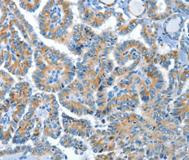 COG1 Antibody in Immunohistochemistry (Paraffin) (IHC (P))