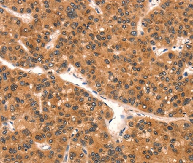 SPINLW1 Antibody in Immunohistochemistry (Paraffin) (IHC (P))