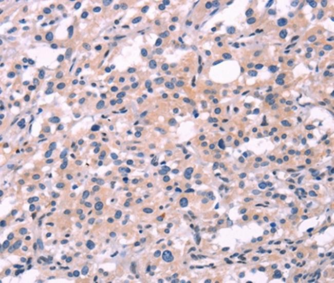 FGF16 Antibody in Immunohistochemistry (Paraffin) (IHC (P))