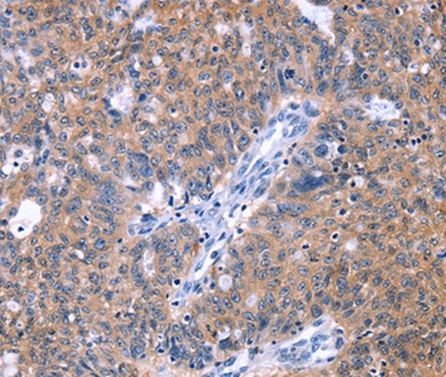 HDBP2 Antibody in Immunohistochemistry (Paraffin) (IHC (P))