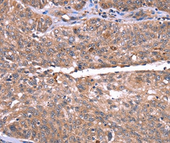 HRG Antibody in Immunohistochemistry (Paraffin) (IHC (P))