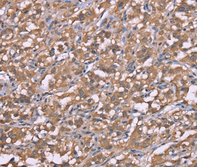 HRH3 Antibody in Immunohistochemistry (Paraffin) (IHC (P))