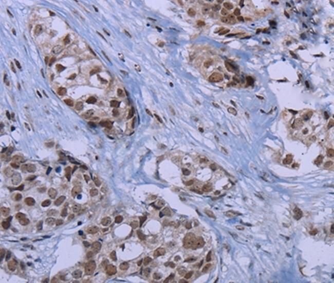 ID3 Antibody in Immunohistochemistry (Paraffin) (IHC (P))