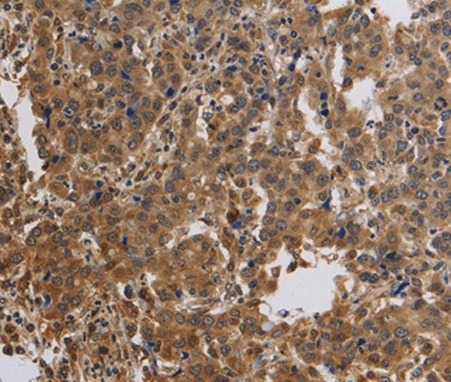 KCNMB4 Antibody in Immunohistochemistry (Paraffin) (IHC (P))