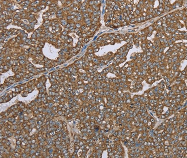 Lass4 Antibody in Immunohistochemistry (Paraffin) (IHC (P))