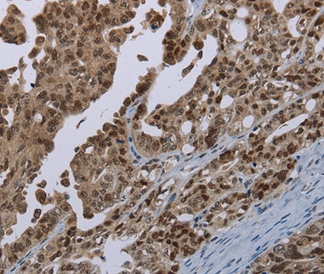 MAGEB18 Antibody in Immunohistochemistry (Paraffin) (IHC (P))