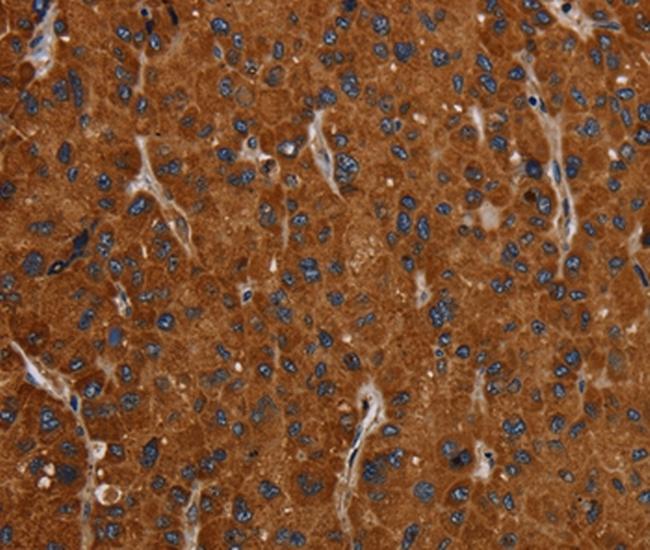 SLC22A12 Antibody in Immunohistochemistry (Paraffin) (IHC (P))