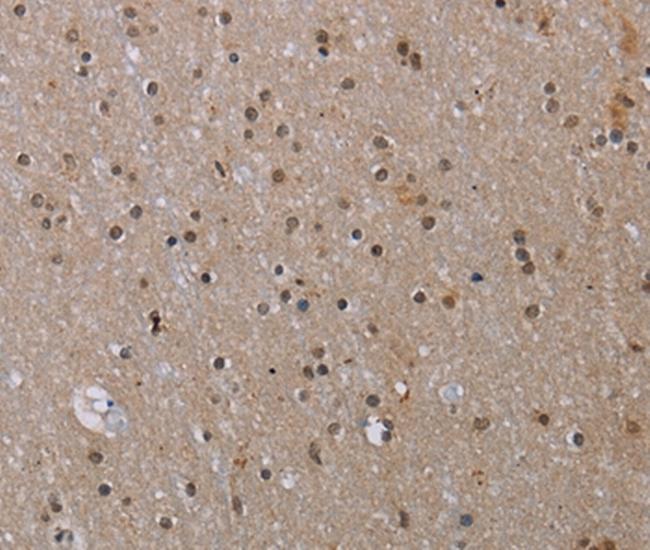 MED12 Antibody in Immunohistochemistry (Paraffin) (IHC (P))