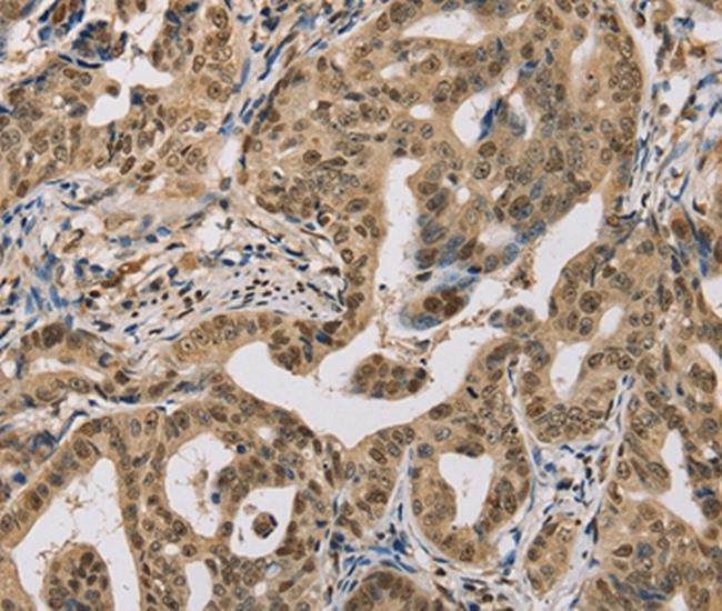 CENPV Antibody in Immunohistochemistry (Paraffin) (IHC (P))