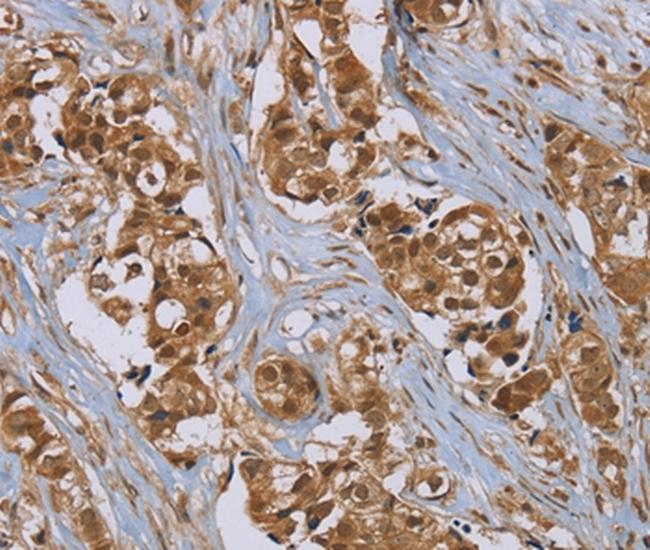 PUS10 Antibody in Immunohistochemistry (Paraffin) (IHC (P))