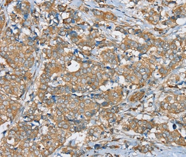 SERINC4 Antibody in Immunohistochemistry (Paraffin) (IHC (P))