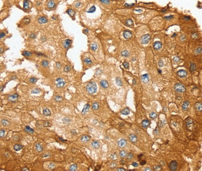 SESN2 Antibody in Immunohistochemistry (Paraffin) (IHC (P))