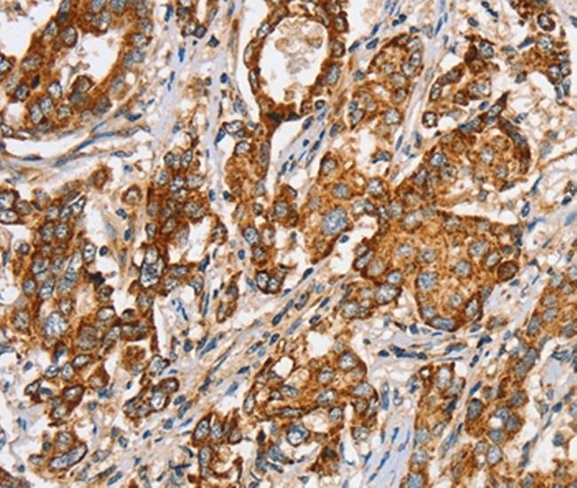 SLC5A11 Antibody in Immunohistochemistry (Paraffin) (IHC (P))