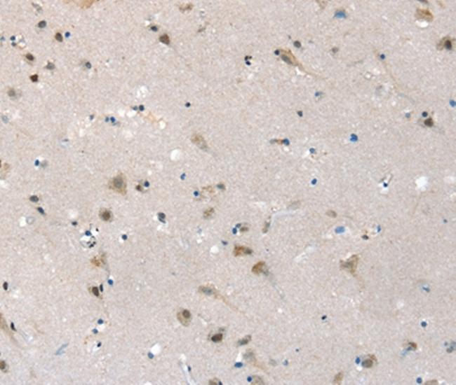 SLC6A7 Antibody in Immunohistochemistry (Paraffin) (IHC (P))