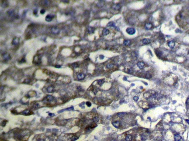 SLC25A2 Antibody in Immunohistochemistry (Paraffin) (IHC (P))