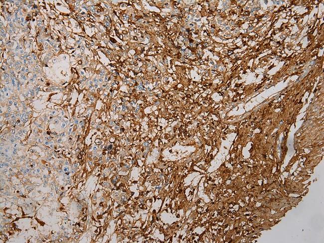 STX18 Antibody in Immunohistochemistry (Paraffin) (IHC (P))