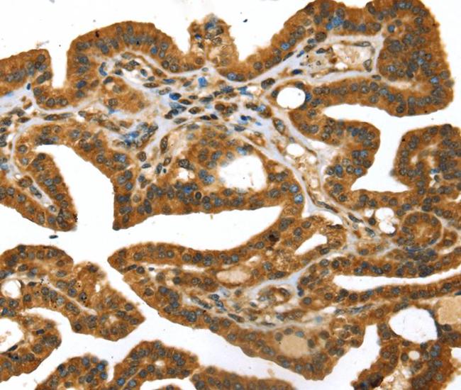 STX11 Antibody in Immunohistochemistry (Paraffin) (IHC (P))