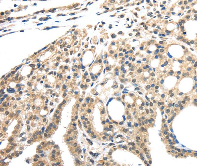 INHBB Antibody in Immunohistochemistry (Paraffin) (IHC (P))