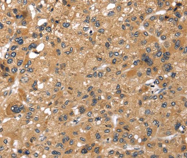 LONP1 Antibody in Immunohistochemistry (Paraffin) (IHC (P))