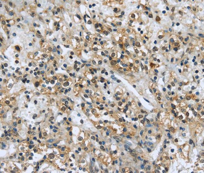 USP28 Antibody in Immunohistochemistry (Paraffin) (IHC (P))