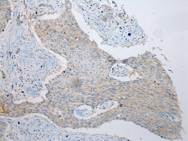 VPS4A Antibody in Immunohistochemistry (Paraffin) (IHC (P))