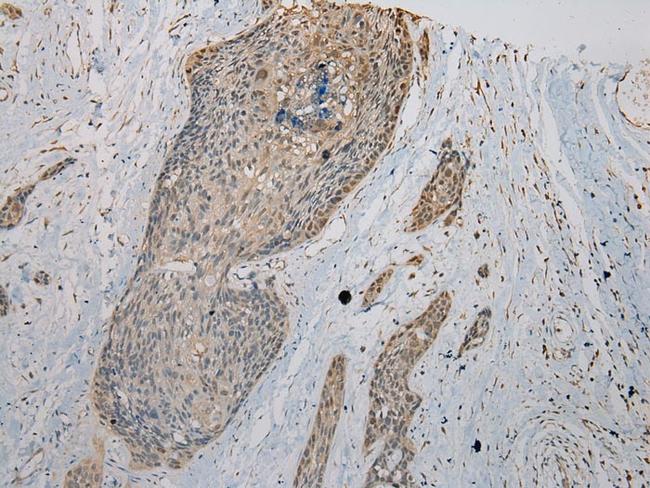 VPS36 Antibody in Immunohistochemistry (Paraffin) (IHC (P))