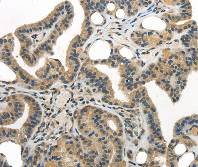 WDR36 Antibody in Immunohistochemistry (Paraffin) (IHC (P))