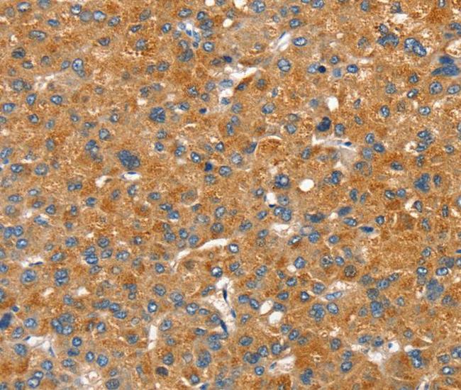 PMAT Antibody in Immunohistochemistry (Paraffin) (IHC (P))