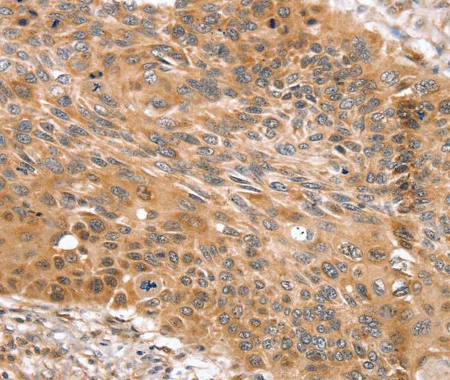 SNX11 Antibody in Immunohistochemistry (Paraffin) (IHC (P))