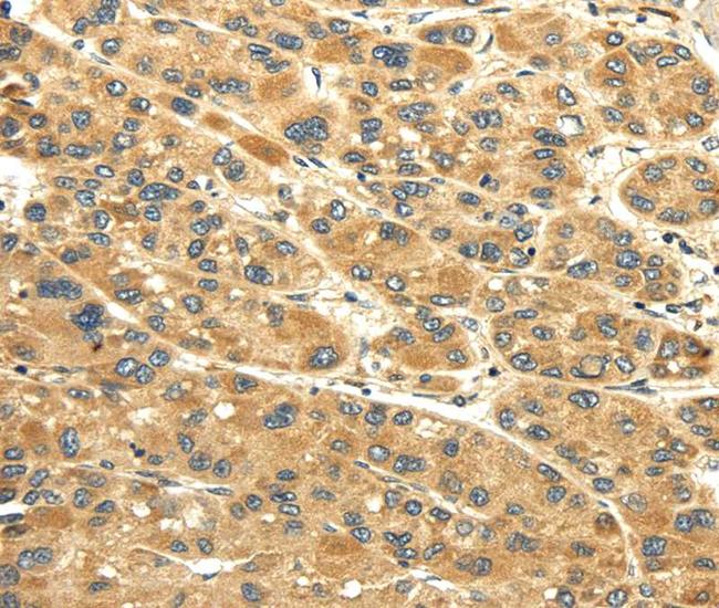 UACA Antibody in Immunohistochemistry (Paraffin) (IHC (P))