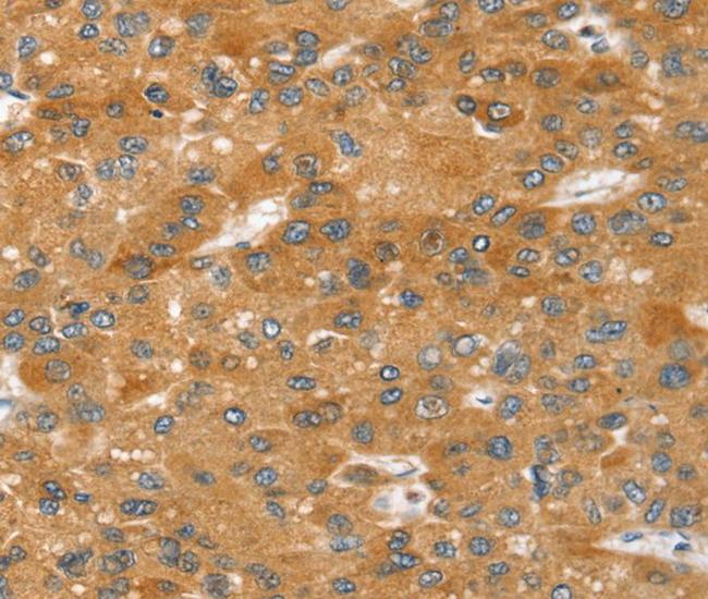 SRGAP2 Antibody in Immunohistochemistry (Paraffin) (IHC (P))