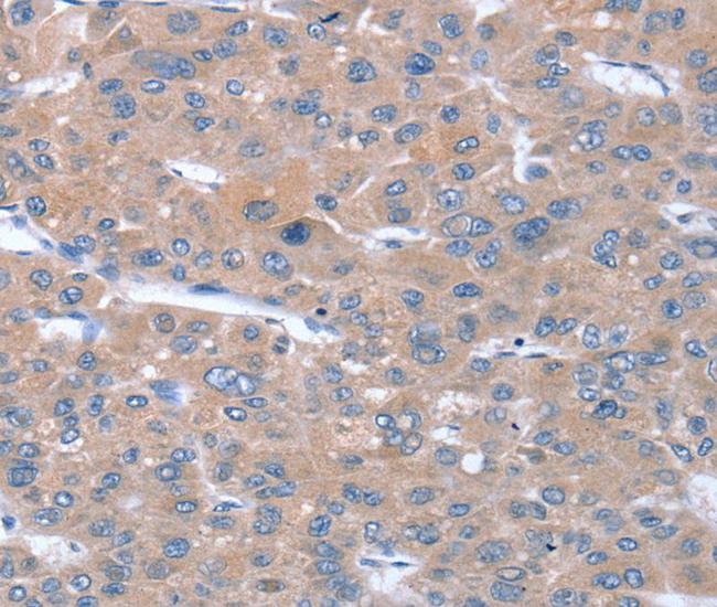 SULF1 Antibody in Immunohistochemistry (Paraffin) (IHC (P))