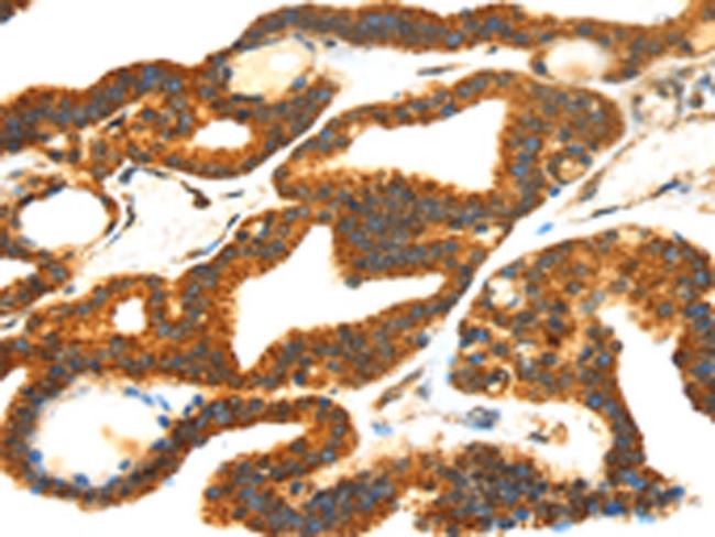 SMYD4 Antibody in Immunohistochemistry (Paraffin) (IHC (P))