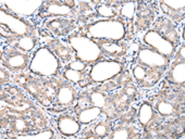 TIM17 Antibody in Immunohistochemistry (Paraffin) (IHC (P))